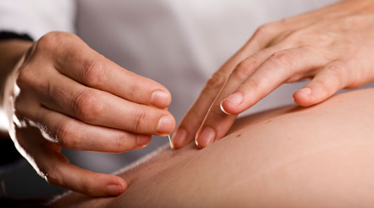 acupuncture website stock photo